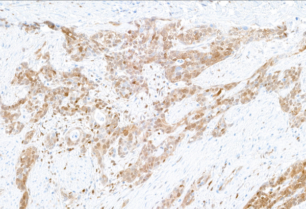 Anti-Galectin-9/Gal-9 Recombinant Monoclonal