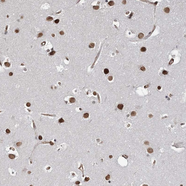 Anti-ATP11B