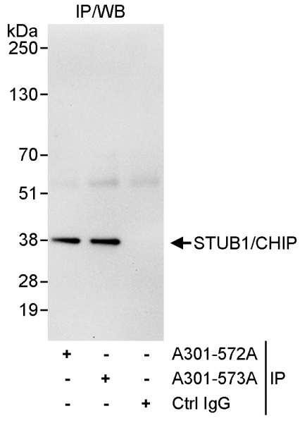 Anti-STUB1/CHIP