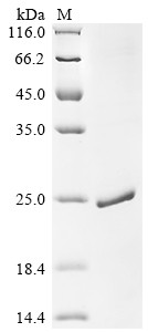 Myoglobin (MB), swine, recombinant