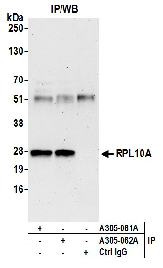 Anti-RPL10A/Ribosomal Protein L10a