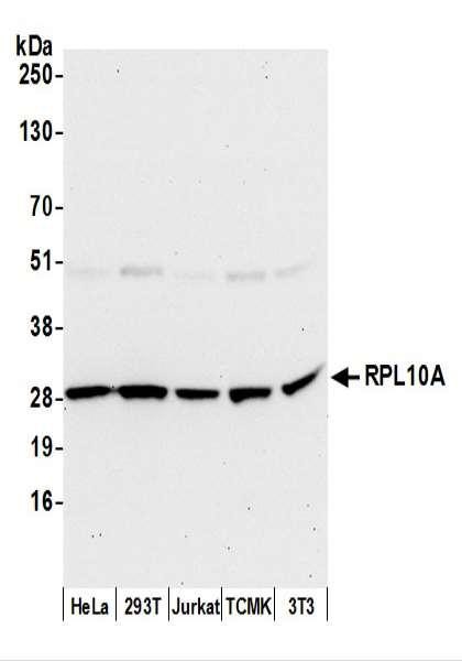 Anti-RPL10A/Ribosomal Protein L10a