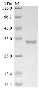 ER membrane protein complex subunit 10 (EMC10), partial, human, recombinant