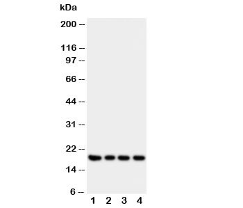 Anti-Interferon gamma