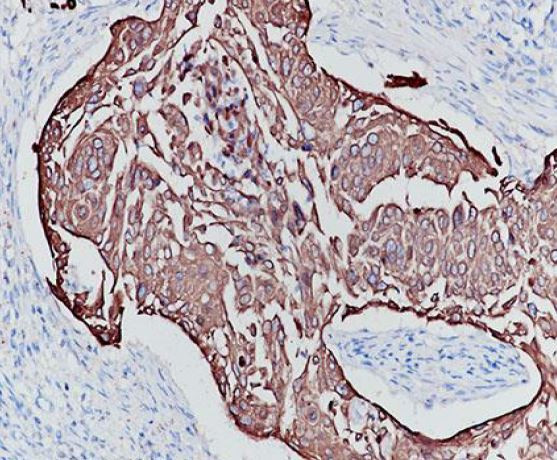 Anti-Type I Cytokeratins, clone SQab18100