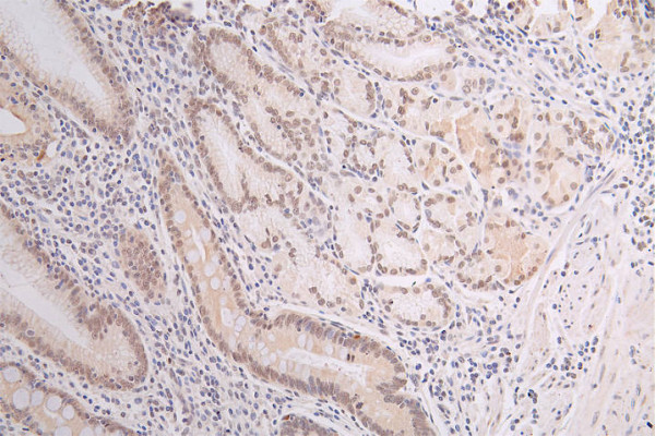 Anti-DEK Recombinant Monoclonal, clone 20D2