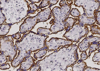 Anti-CD46 Monoclonal Recombinant Antibody