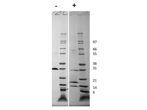 Platelet Derived Growth Factor-AB