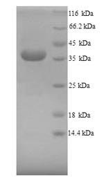 Arginase-1 (Arg1), mouse, recombinant