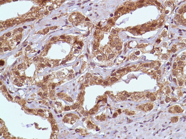 Anti-PIM-1
