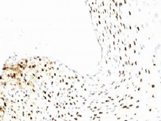 Anti-HPV16 L1, clone CamVir-1