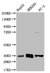 Anti-NTHL1 Recombinant Monoclonal, clone 22H10