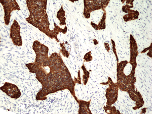 Anti-Cytokeratin-5 (human), Rabbit Monoclonal (RM226)