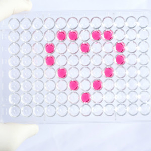Human Cytochrome P450 2C19 (CYP2C19) ELISA Kit