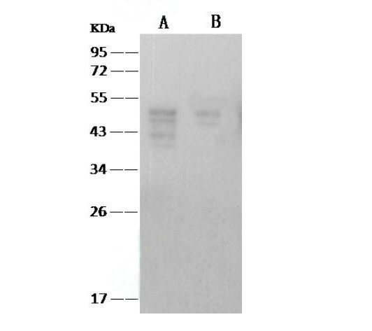 Anti-SARS-CoV Nucleoprotein / NP, clone 08