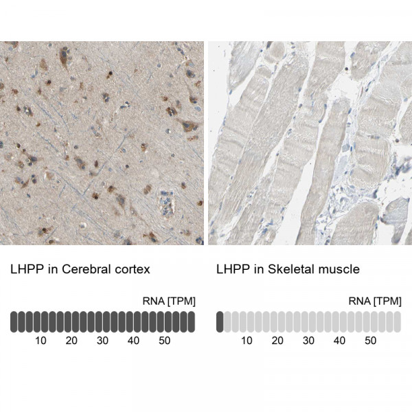 Anti-LHPP
