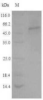 Tryptophan 5-hydroxylase 2 (TPH2), human, recombinant