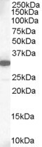 Anti-MCL1, C-terminal