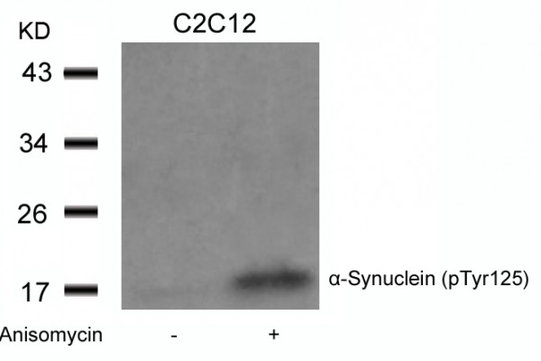 Anti-phospho-alpha Synuclein (Tyr125)
