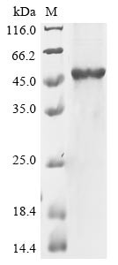 Putative pregnancy-specific beta-1-glycoprotein 7 (PSG7), human, recombinant