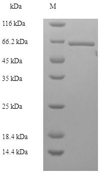 Lys-63-specific deubiquitinase BRCC36 (BRCC3), human, recombinant