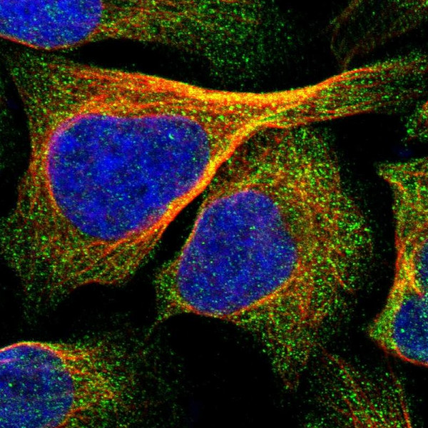 Anti-IPPK