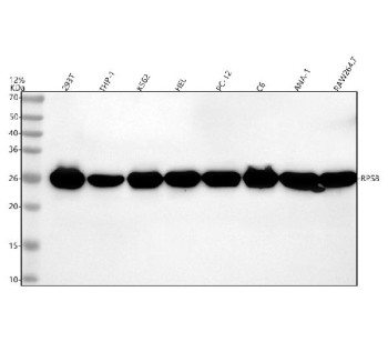 Anti-RPS8 / Ribosomal protein S8, clone 30R72
