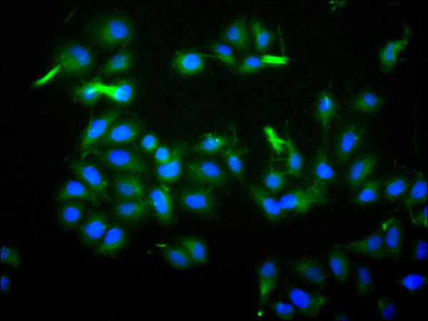 Anti-ILDR2, recombinant clone 13G7