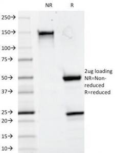 Anti-CD20 (B-cell marker), clone 93-1B3