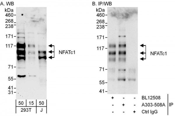 Anti-NFATc1