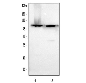 Anti-RECK / Reversion-inducing cysteine-rich protein with Kazal motifs