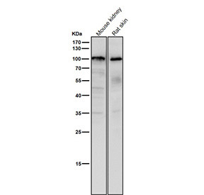 Anti-USP5 / Ubiquitin specific peptidase 5, clone 32U18