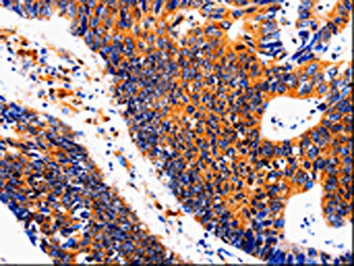 Anti-IL18BP