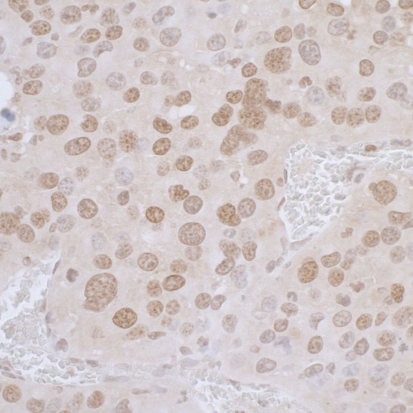 Anti-LAP2 alpha/TMPO