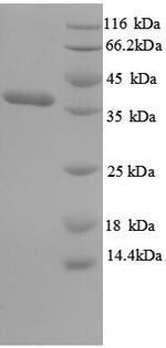 Outer membrane protein A (ompA), partial, Salmonella typhi, recombinant