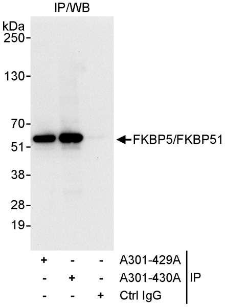 Anti-FKBP5/FKBP51