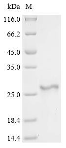 Adrenodoxin, mitochondrial (FDX1), human, recombinant