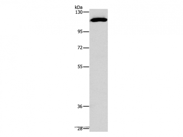 Anti-STAT2