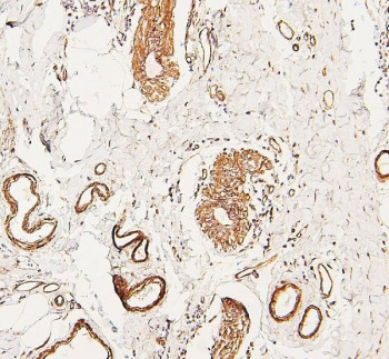 Anti-LPP / Lipoma preferred partner