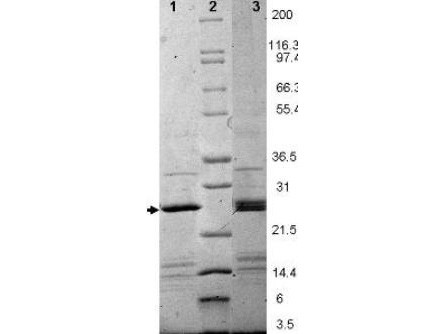 Epstein Barr Virus Induced 3 (EBI-3), human recombinant