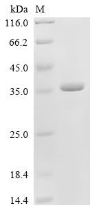 Deleted in azoospermia-like (DAZL), partial, recombinant human