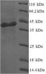 Nicotinamide mononucleotide adenylyltransferase 3 (NMNAT3), human, recombinant