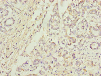 Anti-ANAPC5