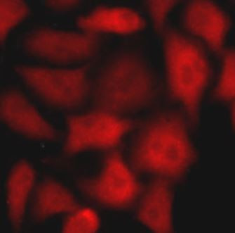 Anti-alpha Fetoprotein