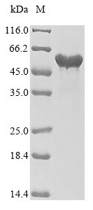 Fibrinogen gamma chain (FGG), human, recombinant