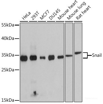 Anti-SNAI1