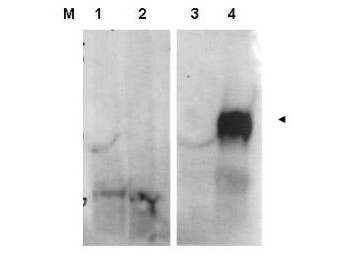 Anti-Fibroblast Activating Protein (FAP)
