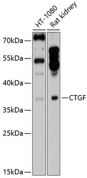 Anti-CTGF