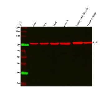 Anti-PLS1 / Plastin-1
