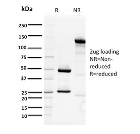 Anti-ORC1 / Origin Recognition Complex 1, clone 7F6/1